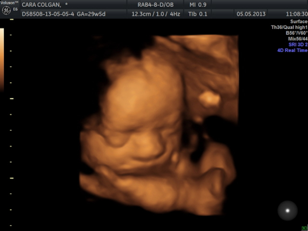 Ein Bildschirm mit Text und einem Bild eines Babys.